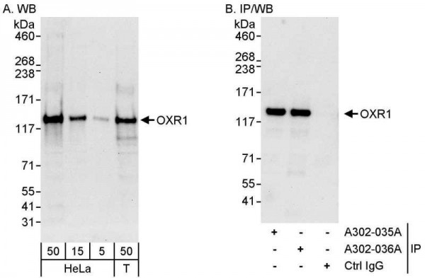 Anti-OXR1