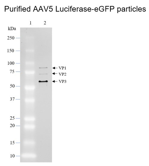 AAV5 Luciferase-eGFP