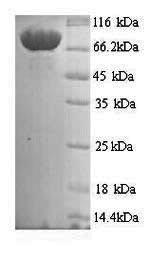 Mannan-binding lectin serine protease 1 (MASP1), human, recombinant