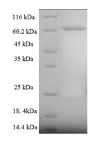 Cytoplasmic domain polyadenylation element-binding protein 1 (CPEB1), human, recombinant