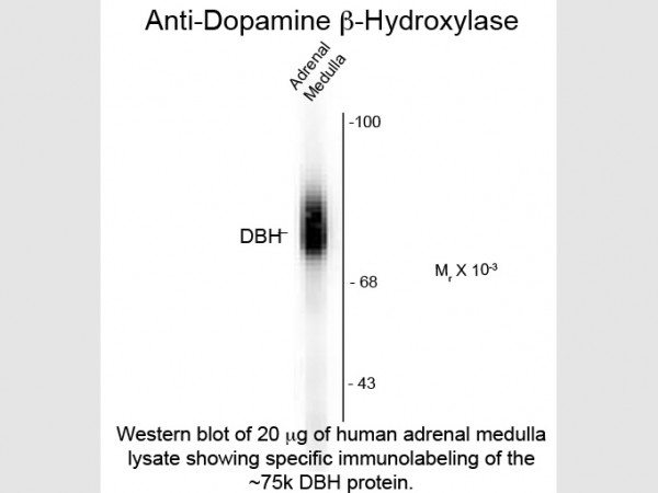 Anti-Dopamine ß-Hydroxylase