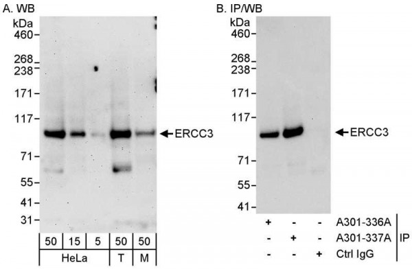 Anti-ERCC3