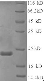 Sex-determining region Y protein (Sry), partial, mouse, recombinant