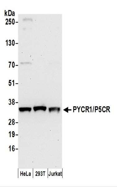 Anti-PYCR1/P5CR