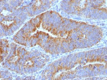 Anti-Thomsen-Friedenreich Antigen / CD176 (Pan Carcinoma Marker) Monoclonal Antibody (Clone: SPM320)