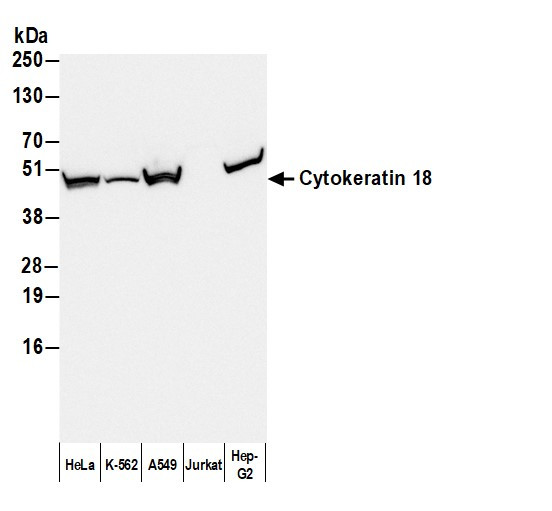 Anti-Mouse IgG1, HRP conjugated