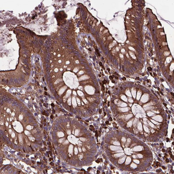 Anti-MYH14