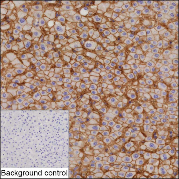 Anti-CA14