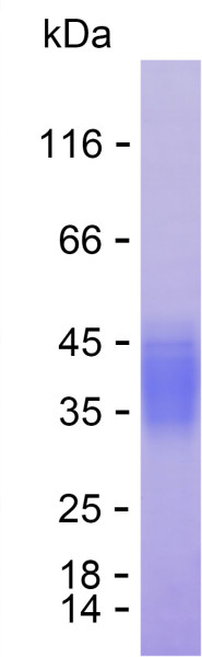 Recombinant Human P2RX4 Protein