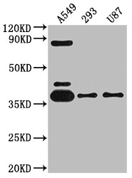 Anti-ADORA1 Recombinant Monoclonal, clone 10D12
