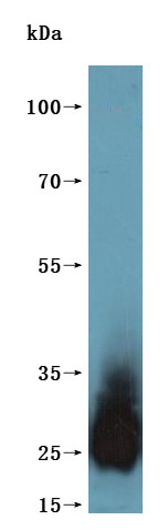 Tetraspanin-8 (TSPAN8)-VLPs (Active), recombinant human