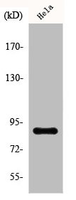 Anti-Phospho-STAT5A/STAT5B (S726/731)