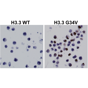 Anti-Histone H3.3 G34V (human), Rabbit Monoclonal (RM307)