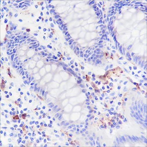 Anti-Recombinant CD169, clone A161