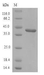 Lumican (Lum), rat, recombinant