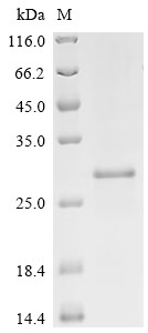 Cyclin-dependent kinase inhibitor 1 (Cdkn1a), mouse, recombinant