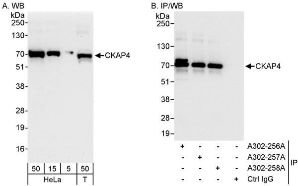Anti-CKAP4