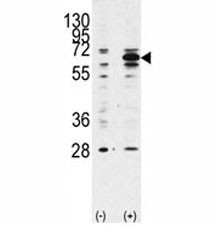 Anti-Beclin 1