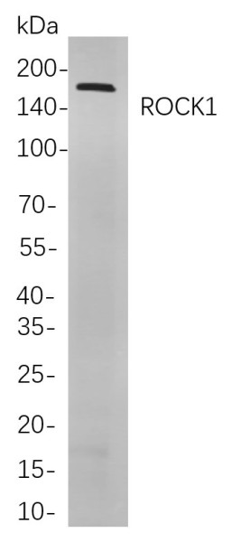 Anti-Recombinant ROCK1, clone 12B7