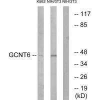 Anti-GCNT6