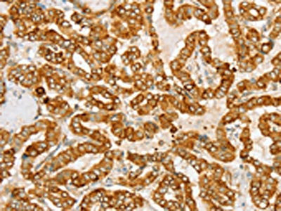 Anti-PTPN22