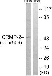 Anti-Phospho-DPYSL2 (Thr509)