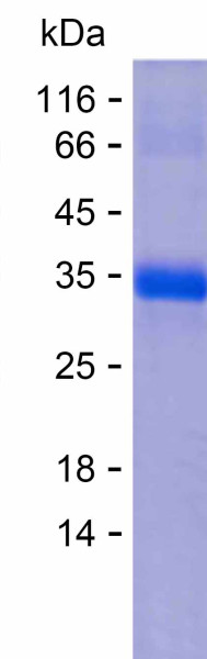 JAK2 (human), recombinant protein