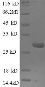 TATA-box-binding protein (SPT15), Saccharomyces cerevisiae, recombinant