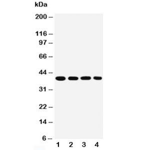 Anti-MTCO1