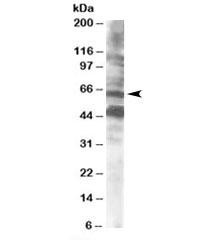 Anti-CPEB