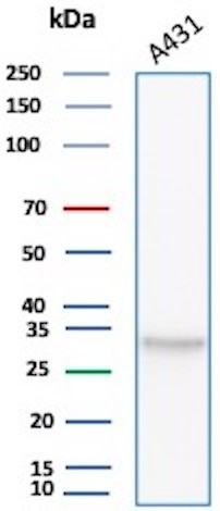 Anti-Bcl-X (Apoptosis Marker), clone BCL2L1/1762