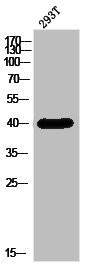 Anti-ZDHHC9