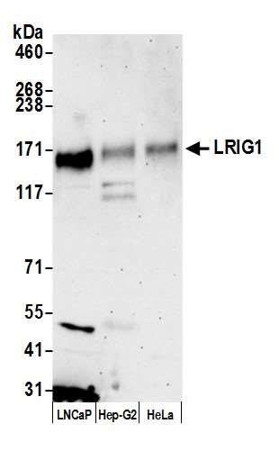 Anti-LRIG1