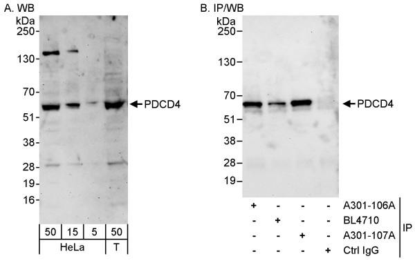 Anti-PDCD4