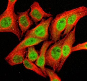 Anti-SFMBT2 / Scm-like with four MBT domains protein 2