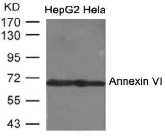 Anti-ANXA6