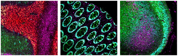 AtlasPlex Large 5-Plex Kit
