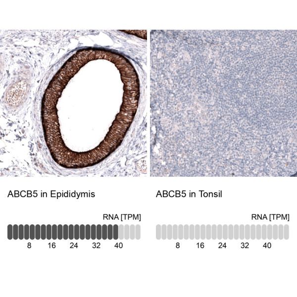 Anti-ABCB5, clone CL13618