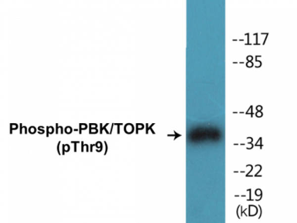 PBK/TOPK (Phospho-Thr9) Colorimetric Cell-Based ELISA Kit