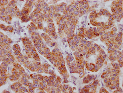 Anti-ACVR2B Recombinant Monoclonal, clone 7B10
