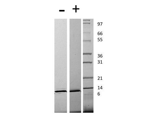 Monocyte Chemotactic Protein-3 (CCL7)