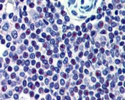 Anti-HMG20A, C-terminal