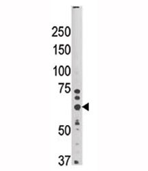 Anti-HRD1