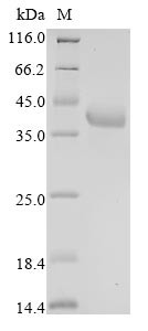 Fructose-bisphosphate aldolase A (ALDOA), human, recombinant