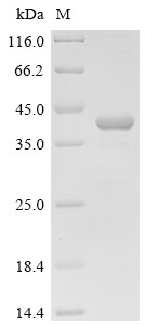 Cyclin-G-associated kinase (GAK), partial, human, recombinant