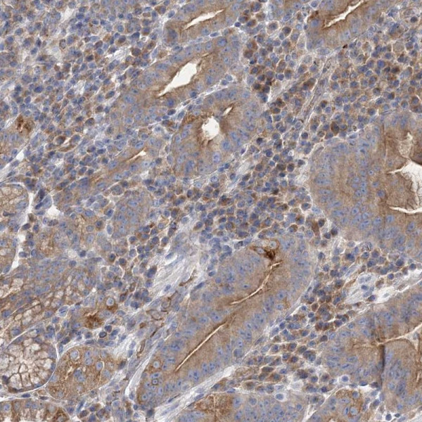 Anti-ATP11B
