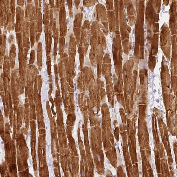 Anti-PHOSPHO1