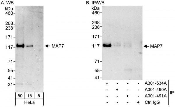 Anti-MAP7