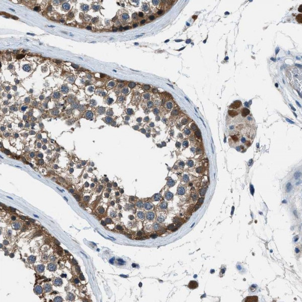 Anti-ACP1