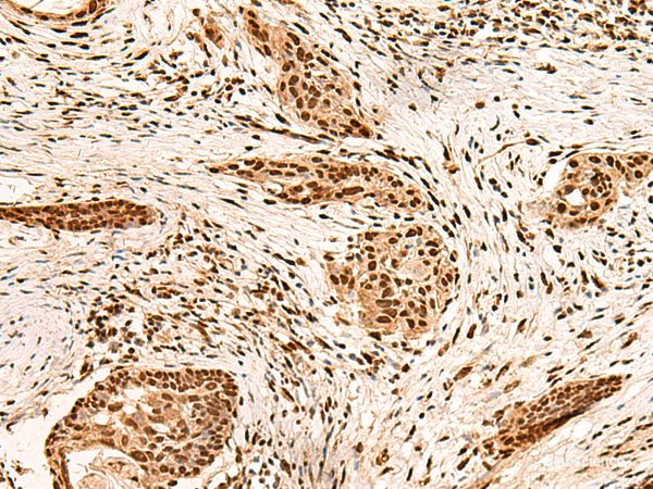 Anti-PAFAH1B2
